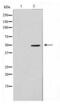 ADP Dependent Glucokinase antibody, LS-C416148, Lifespan Biosciences, Western Blot image 