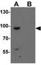 Shroom Family Member 1 antibody, GTX32098, GeneTex, Western Blot image 