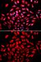 Calcium/Calmodulin Dependent Protein Kinase IV antibody, GTX53923, GeneTex, Immunofluorescence image 