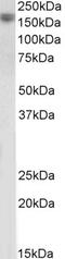 Phosphoglycerate Kinase 1 antibody, 43-549, ProSci, Enzyme Linked Immunosorbent Assay image 