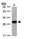 Tetraspanin 1 antibody, TA307931, Origene, Western Blot image 