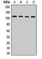 Tuftelin Interacting Protein 11 antibody, LS-C668719, Lifespan Biosciences, Western Blot image 