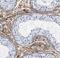 Tetratricopeptide Repeat Domain 32 antibody, FNab09082, FineTest, Immunohistochemistry paraffin image 