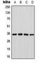 Cathepsin H antibody, orb216083, Biorbyt, Western Blot image 