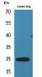 Endothelin-1 antibody, STJ96512, St John