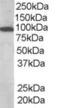 Vav Guanine Nucleotide Exchange Factor 3 antibody, EB06467, Everest Biotech, Western Blot image 