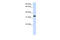 Store-Operated Calcium Entry Associated Regulatory Factor antibody, ARP47216_P050, Aviva Systems Biology, Western Blot image 