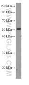 Transducin Beta Like 2 antibody, 66307-1-Ig, Proteintech Group, Enzyme Linked Immunosorbent Assay image 