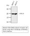 Ras Homolog Family Member A antibody, STJ95442, St John