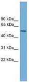 EF-Hand Calcium Binding Domain 3 antibody, TA337784, Origene, Western Blot image 