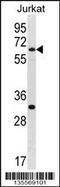 SWI/SNF Related, Matrix Associated, Actin Dependent Regulator Of Chromatin, Subfamily D, Member 1 antibody, 58-315, ProSci, Western Blot image 