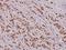 Histone Deacetylase 8 antibody, A01843S39, Boster Biological Technology, Immunohistochemistry frozen image 