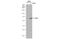 E2F-1 antibody, GTX70167, GeneTex, Western Blot image 