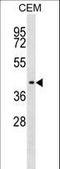 Indian Hedgehog Signaling Molecule antibody, LS-C165163, Lifespan Biosciences, Western Blot image 