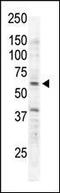 Receptor Like Tyrosine Kinase antibody, PA5-14733, Invitrogen Antibodies, Western Blot image 