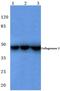 Collagenase 3 antibody, AP06226PU-N, Origene, Western Blot image 