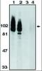 ADAM Metallopeptidase Domain 17 antibody, orb86816, Biorbyt, Western Blot image 