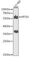 Keratin 10 antibody, GTX32547, GeneTex, Western Blot image 