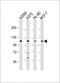 LAD-1 antibody, GTX80563, GeneTex, Western Blot image 