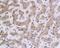 BRCA1 DNA Repair Associated antibody, orb338847, Biorbyt, Immunohistochemistry paraffin image 
