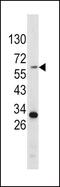 Tyrosinase antibody, PA5-14232, Invitrogen Antibodies, Western Blot image 