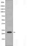 Lymphotoxin Beta antibody, orb225808, Biorbyt, Western Blot image 