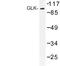 Mitogen-Activated Protein Kinase Kinase Kinase Kinase 3 antibody, LS-C177171, Lifespan Biosciences, Western Blot image 