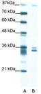 PBX/Knotted 1 Homeobox 2 antibody, TA333708, Origene, Western Blot image 