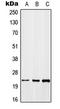 Growth Arrest And DNA Damage Inducible Beta antibody, LS-B13641, Lifespan Biosciences, Western Blot image 