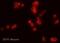 Collagen Type II Alpha 1 Chain antibody, ab34712, Abcam, Immunofluorescence image 