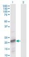 Odontogenic ameloblast-associated protein antibody, MA5-24467, Invitrogen Antibodies, Western Blot image 