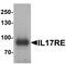 Interleukin 17 Receptor E antibody, orb179050, Biorbyt, Western Blot image 