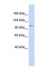 Advillin antibody, NBP1-80007, Novus Biologicals, Western Blot image 