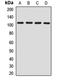 Coatomer Protein Complex Subunit Beta 1 antibody, orb411786, Biorbyt, Western Blot image 