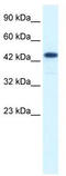 REST corepressor 3 antibody, TA334759, Origene, Western Blot image 