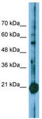 Core-Binding Factor Subunit Beta antibody, TA329190, Origene, Western Blot image 