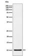 C-C Motif Chemokine Ligand 5 antibody, M00617, Boster Biological Technology, Western Blot image 