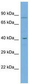 Glycerophosphodiester Phosphodiesterase Domain Containing 5 antibody, TA339565, Origene, Western Blot image 