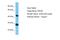 Keratin 80 antibody, A12904, Boster Biological Technology, Western Blot image 