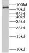 Ribosomal Protein S6 Kinase A2 antibody, FNab07507, FineTest, Western Blot image 