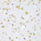 Tumor Suppressor 2, Mitochondrial Calcium Regulator antibody, LS-C335709, Lifespan Biosciences, Immunohistochemistry frozen image 