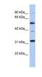 TBC1 Domain Family Member 26 antibody, NBP1-57658, Novus Biologicals, Western Blot image 