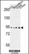 Dipeptidyl Peptidase Like 10 antibody, 63-738, ProSci, Western Blot image 