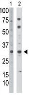 Thymidine Kinase 2 antibody, GTX03284, GeneTex, Western Blot image 