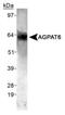 Glycerol-3-Phosphate Acyltransferase 4 antibody, PA1-16960, Invitrogen Antibodies, Western Blot image 