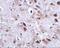 Transmembrane Protein 18 antibody, A05347, Boster Biological Technology, Immunohistochemistry paraffin image 