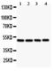 Chromogranin A antibody, PB9097, Boster Biological Technology, Western Blot image 