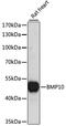 Bone Morphogenetic Protein 10 antibody, 15-829, ProSci, Western Blot image 