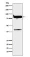 Protein Kinase C Eta antibody, M03292, Boster Biological Technology, Western Blot image 