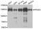 Protein Phosphatase 4 Regulatory Subunit 1 antibody, PA5-76370, Invitrogen Antibodies, Western Blot image 
